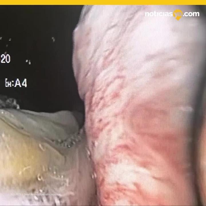 Piton devoro una toalla playera