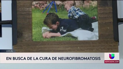 Neurofibromatosis - Clip