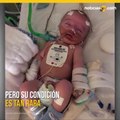 Bebé volvió del coma y le sonrió a papá. Ahora piden apoyo para salvarlo