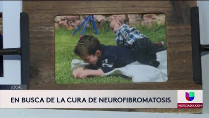 Neurofibromatosis - Clip