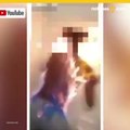 Niña casi muere por reto viral Fire Challenge