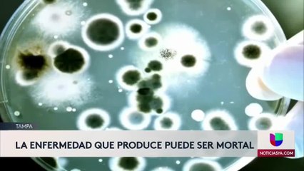 Medidas de prevención contra bacteria "come carne"