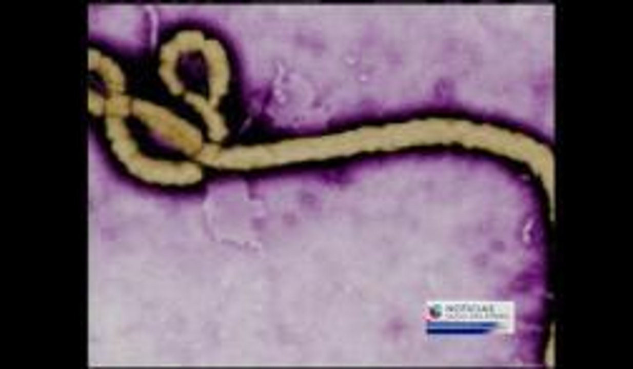 Virus del Ébola