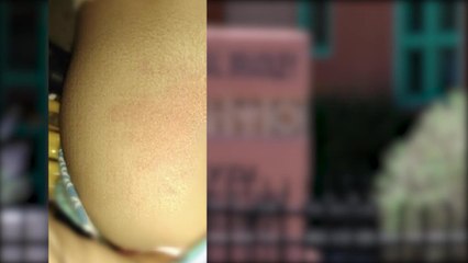 A DAYCARE ABUSE PKG 10PM