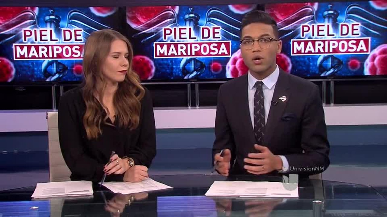 BELENSMOLE PIEL DE MARIPOSA