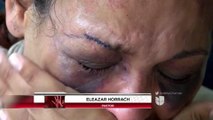 Puertorriqueña teme por su vida tras ser golpeada brutalmente por su pareja