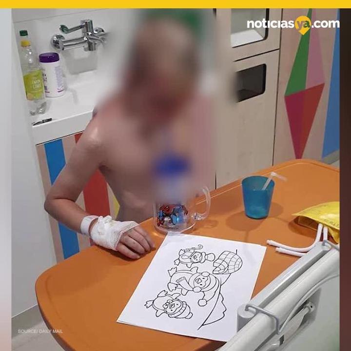 Arrestan a tres por brutales quemaduras en el rostro de niño