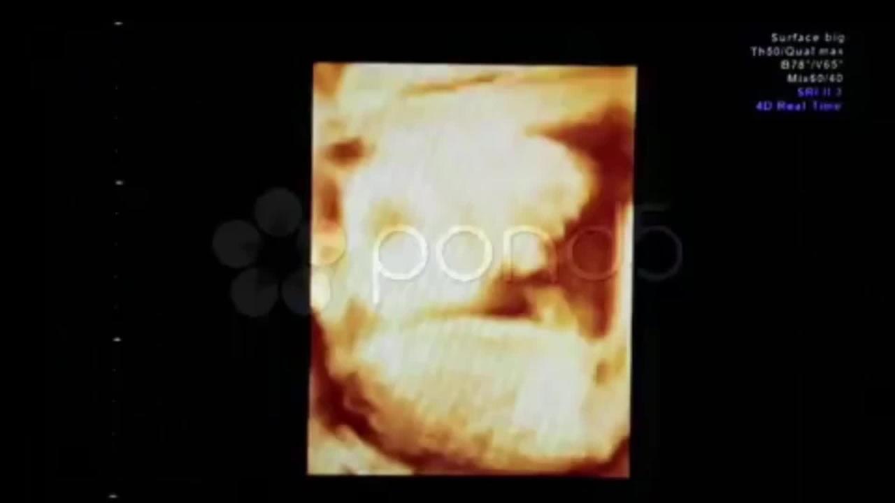ABORTION COLLEGE
