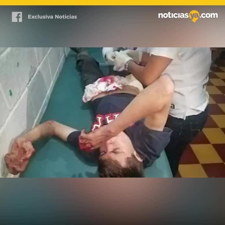 Se corto genitales e intento comerselos