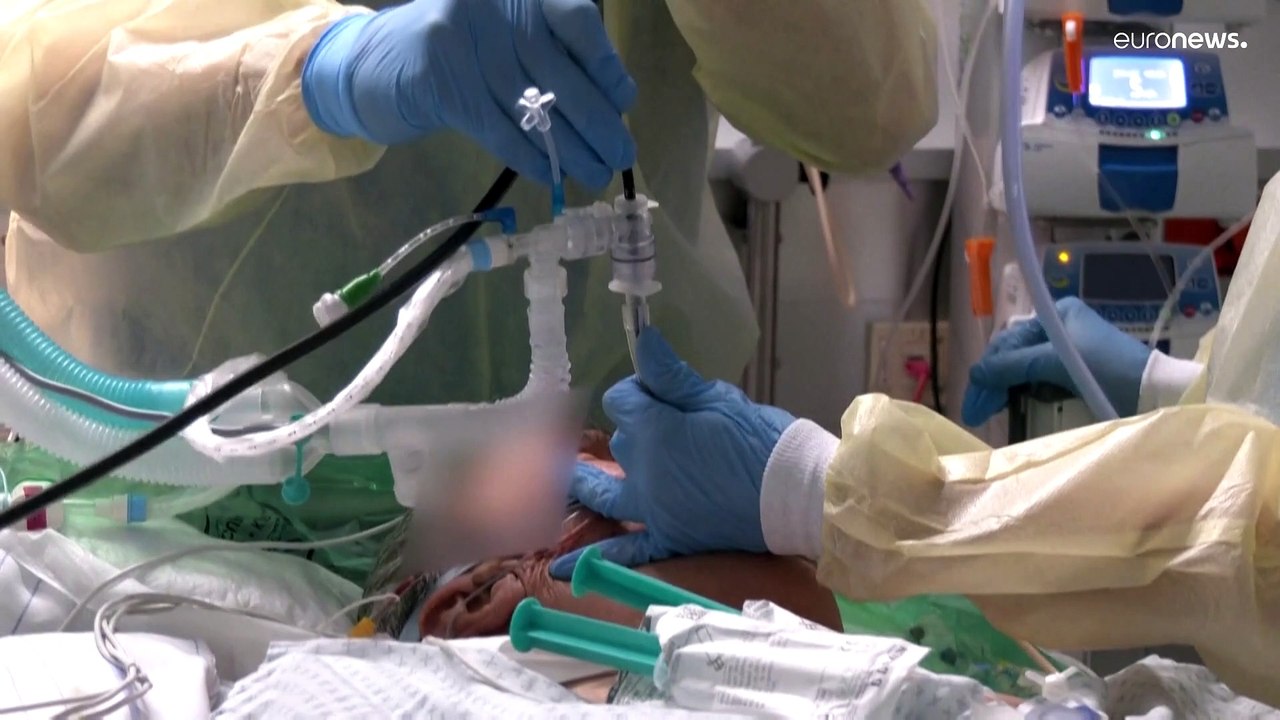 Coronakrise: Personalmangel auf deutschen Intensivstationen