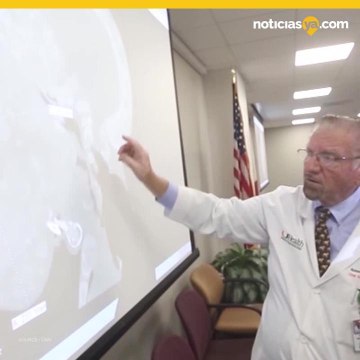 Niño con tumor facial de 10 libras muere después de la cirugía