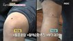 [HEALTHY] Reveal "Blood Spot" to relieve knee pain!, MBC 211115 방송