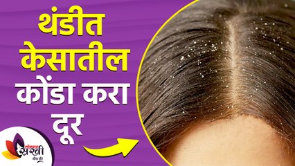 थंडीत केसातील कोंडा घालवण्यासाठी ५ सोपे घरगुती उपाय | 5 Home Remedies to Get Rid of Dandruff