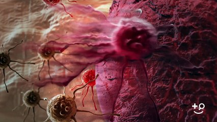 Cancer - Targeted Therapy