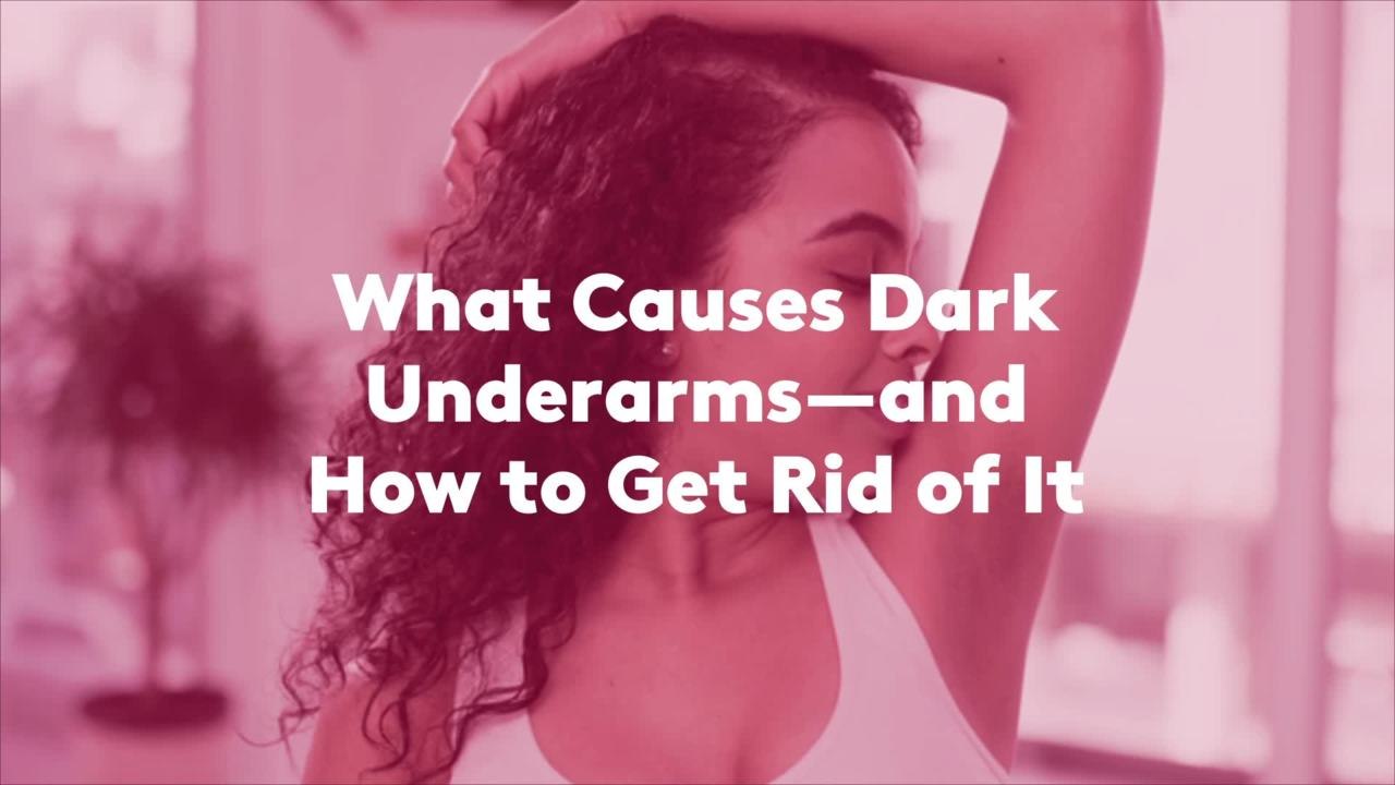 What Causes Dark Underarms—and How to Get Rid of It