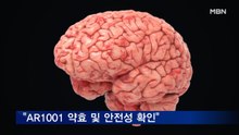 아리바이오 "경구용 치매 치료제 AR1001 약효 및 안전성 확인"
