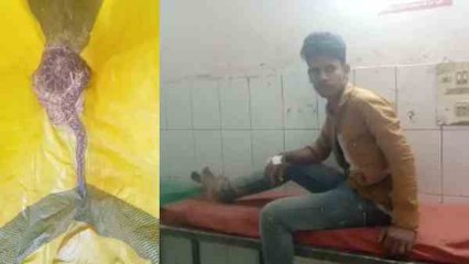 अजगर ने काटा तो बोरे में बंद कर इलाज करवाने अस्पताल पहुंचा शख्स, भाग खड़े हुए डॉक्टर