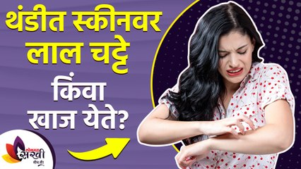 त्वचेवर खाज येतेय? मग करा हे ४ घरगुती उपाय | How to Get Rid of a Winter Rash | Winter Skin Care