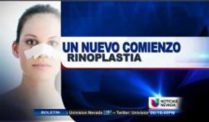 Un nuevo comienzo- Rinoplastia