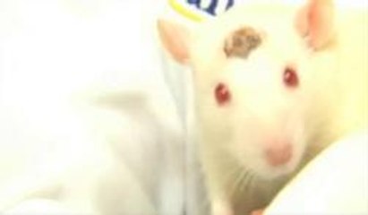 Juegos mentales, implantes en el hipocampo