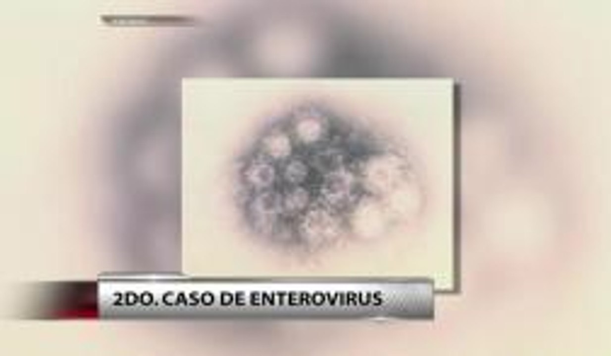 Segundo caso de enterovirus en la Florida