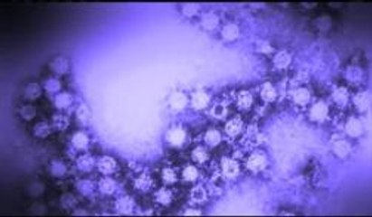 Segundo caso de Enterovirus D-68