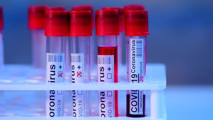 Le tocilizumab, un traitement pour soigner les cas graves de Covid-19 ?