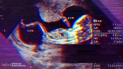 هل تحليل الحمل المنزلي دقيق؟