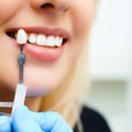 Santé : Ces Soins Dentaires Qui Ne Vous Coûtent Plus Rien En 2020 (1)