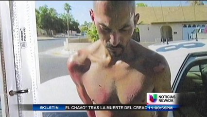 Hombre dice ser víctima de brutalidad policiaca