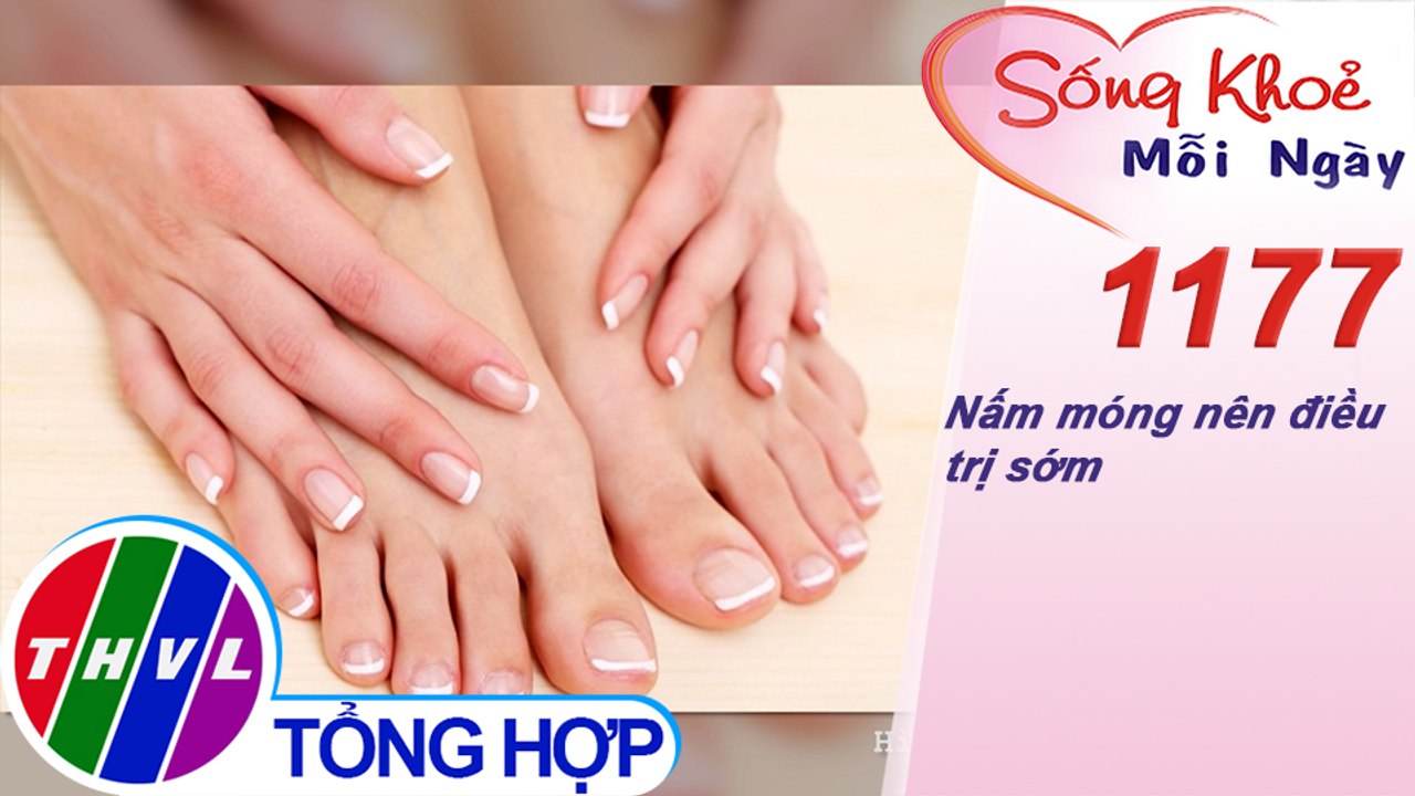 Nấm móng nên điều trị sớm ​| Sống khỏe mỗi ngày - Kỳ 1177