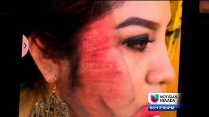 Mesera es atropellada y queda captado en cámara