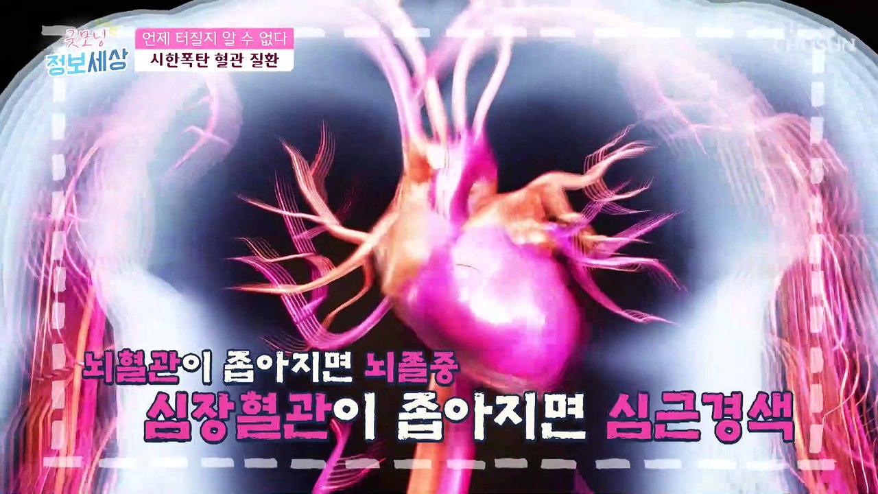 환절기에 ˹심뇌혈관 질환˼ 발병률이 더 높은 이유 ✓ TV CHOSUN 211117 방송