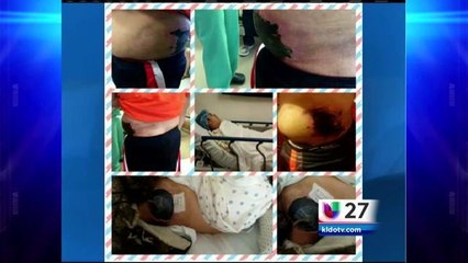 Menor Atropellado Sera Operado