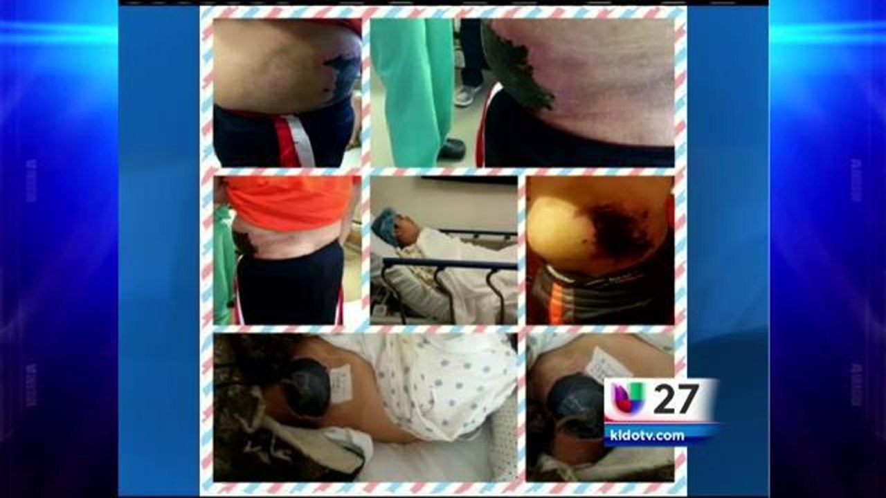 Menor Atropellado Sera Operado
