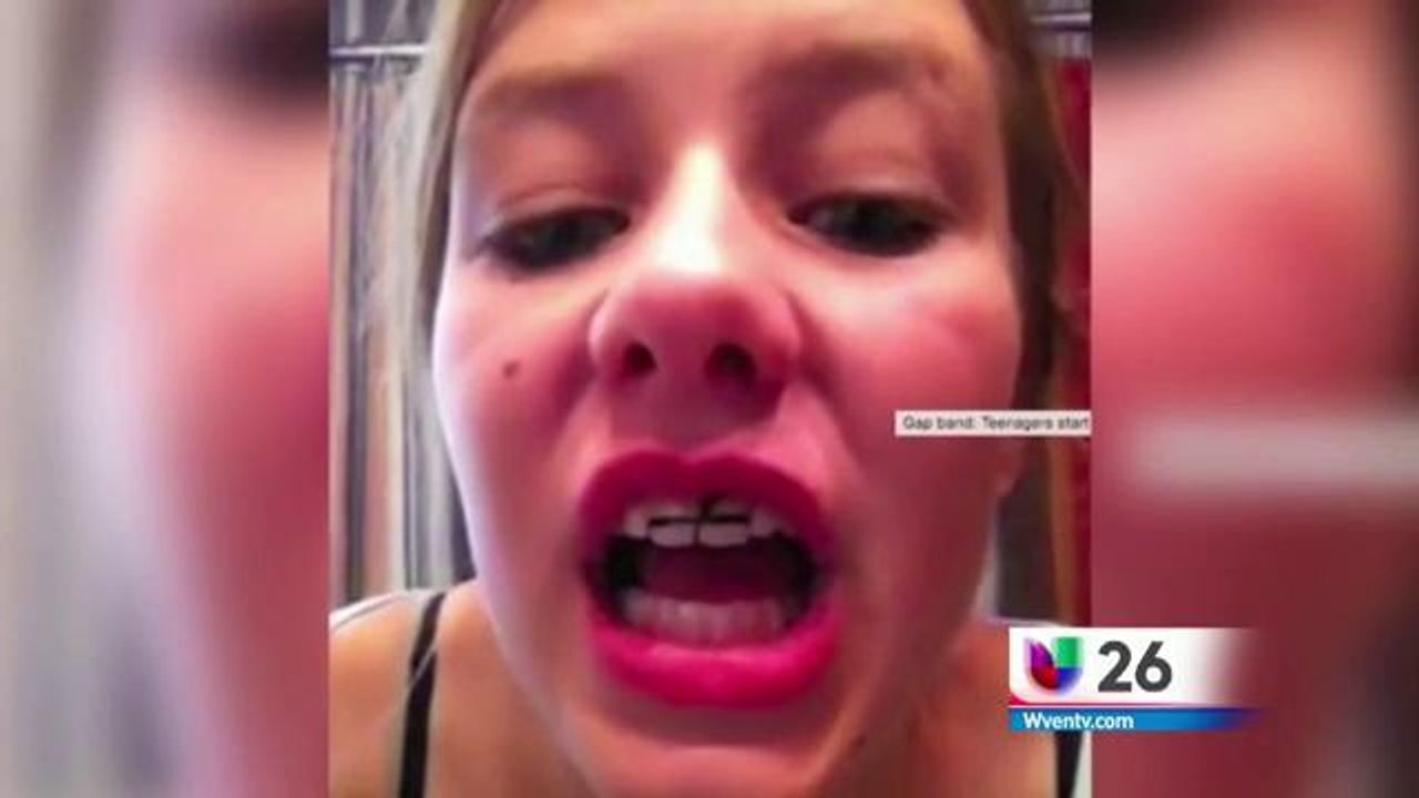 Nueva moda dental