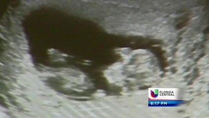 Departamento de Salud de Orange adelanta campañas de concientización de la mortalidad infantil