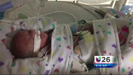 Nacimientos Inusuales