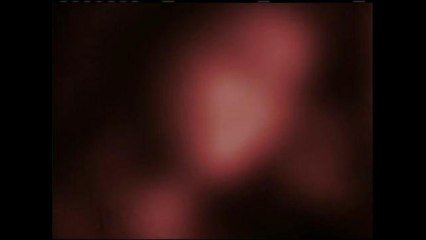 Cicatrices Abiertas.