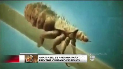 Consejos para prevenir el contagio de piojos