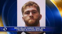 BRUCE MILLER CHARGED WITH 7 FELONIES IN ALLEGED BEATING