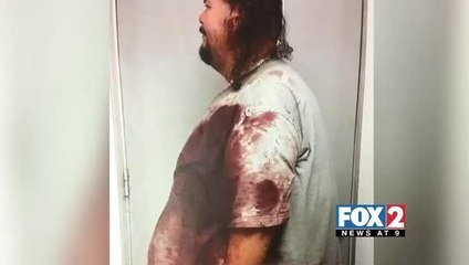 Santa Rosa Woman Stabbed 17 Times