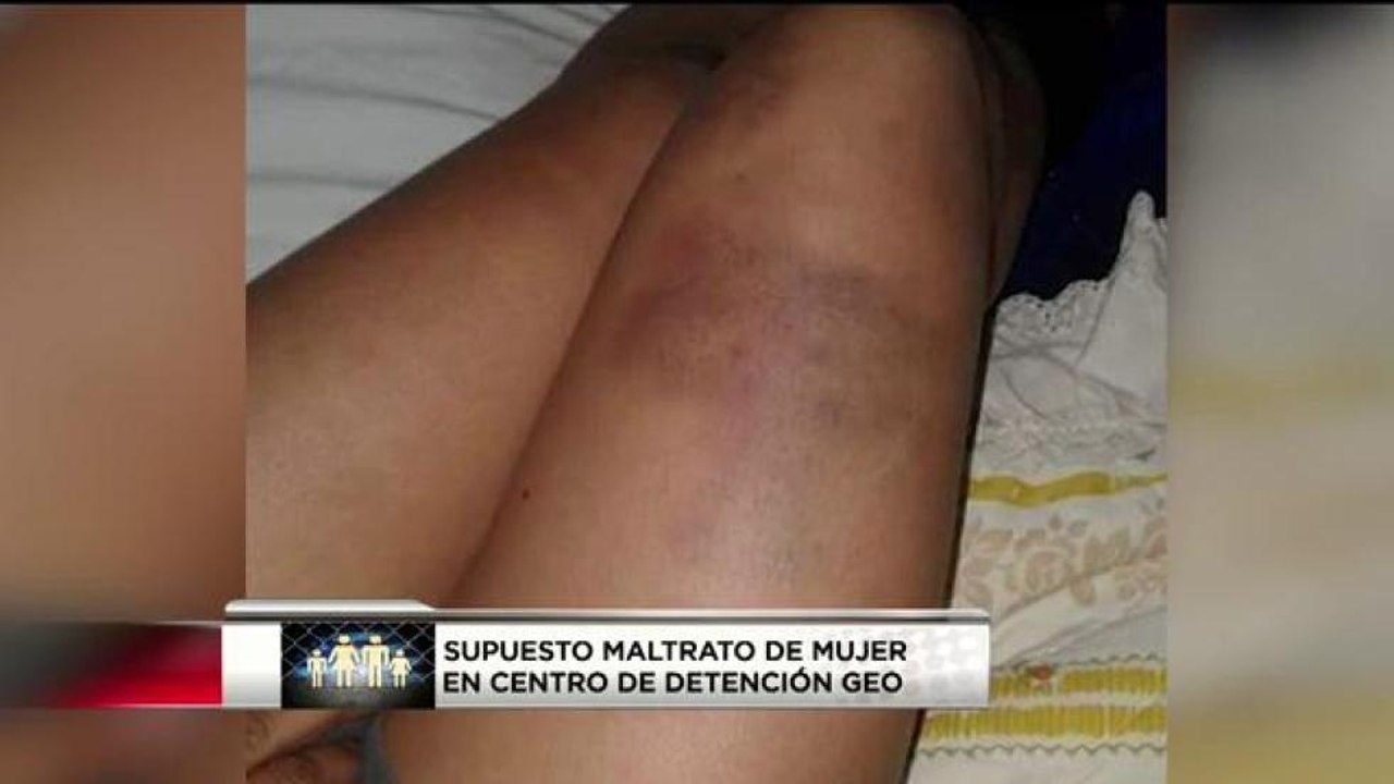 Desde Guatemala habla mujer que asegura fue agredida en GEO