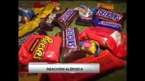 VIDEO: Las alérgias de comida y dulces