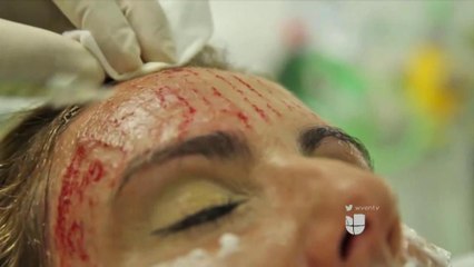Reportaje Especial: Belleza Sangrienta : Parte 1