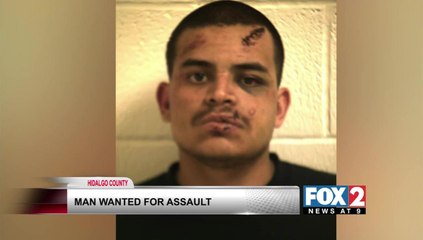 Police Search for Assault Suspect in Hidalgo County