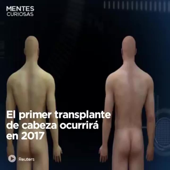 Trasplante de cabeza.mp4