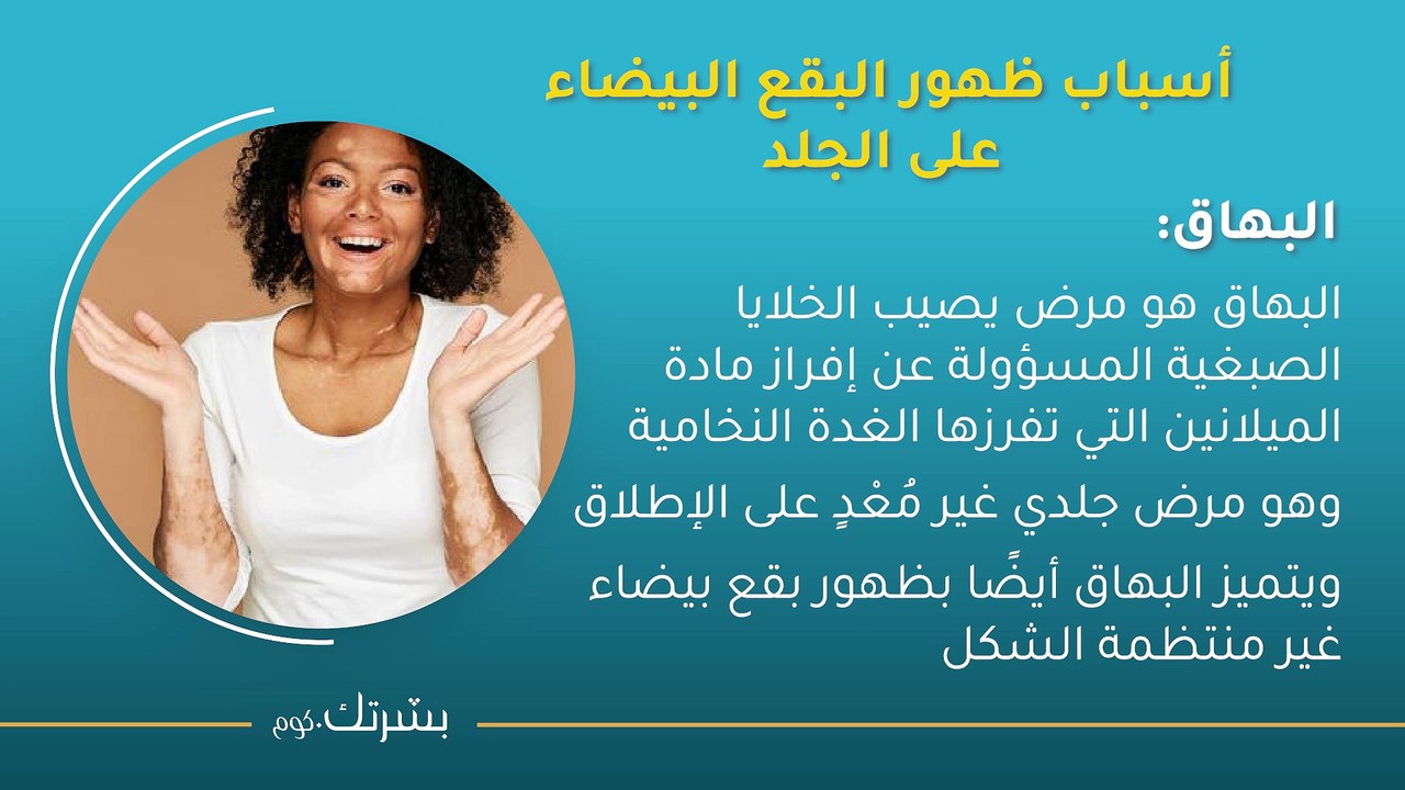 أسباب ظهور بقع بيضاء على الجلد وطرق الوقاية منها