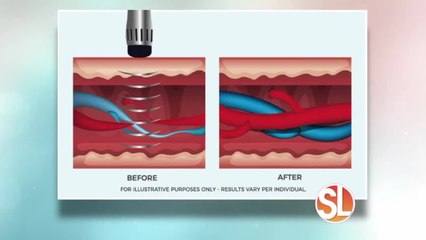 Camelback Medical Clinic offers a non-invasive approach to treating E.D.