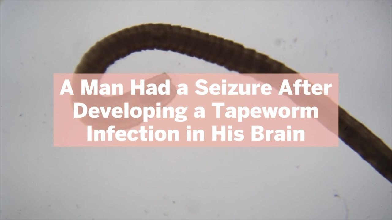 A Man Had a Seizure After Developing a Tapeworm Infection in His Brain